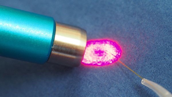 laser-diode-dentaire